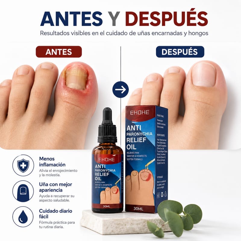 Aceite Eliminador de Hongos y Uñas Encarnadas EHOHE - Image 2