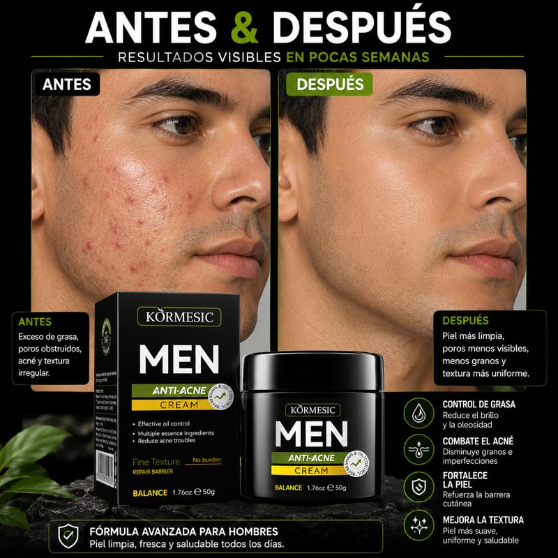 Crema Anti-acne para Hombre KORMESIC - Image 4