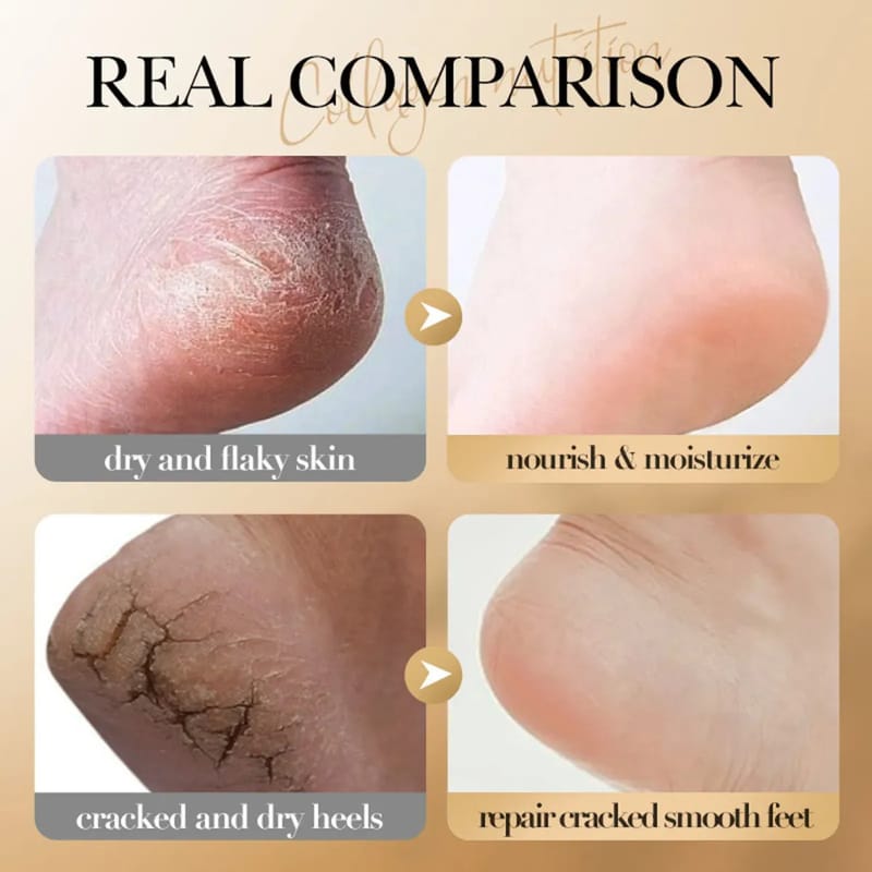 Crema Repara Talones Magic Foot - Image 2